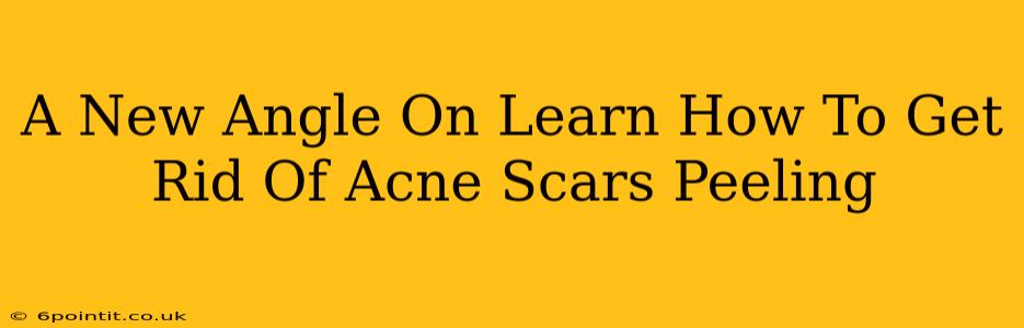 A New Angle On Learn How To Get Rid Of Acne Scars Peeling