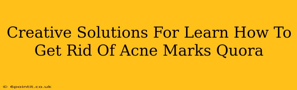 Creative Solutions For Learn How To Get Rid Of Acne Marks Quora