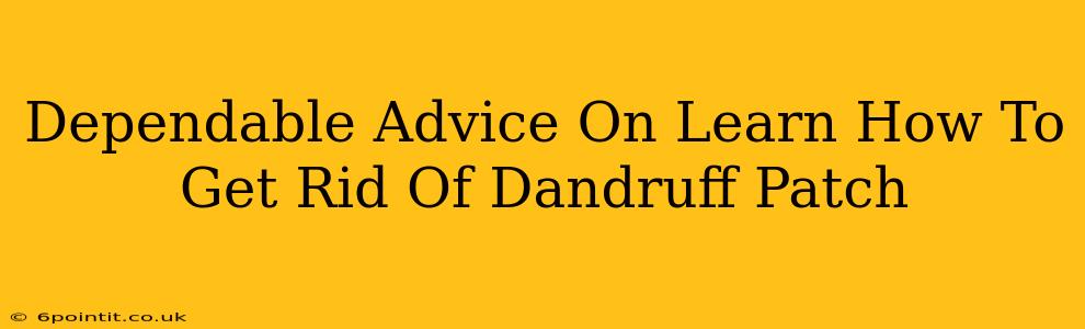 Dependable Advice On Learn How To Get Rid Of Dandruff Patch