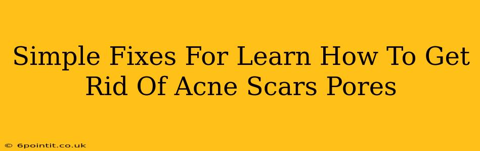 Simple Fixes For Learn How To Get Rid Of Acne Scars Pores